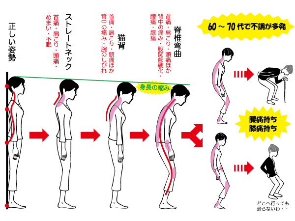 ストレートネック 首肩こり 新百合ヶ丘 鍼灸マッサージ さいとう治療院